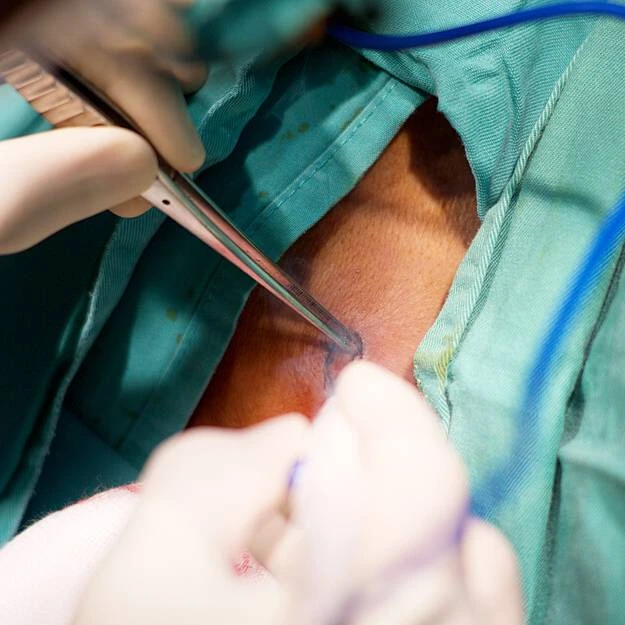 Minor Surgery Clinic