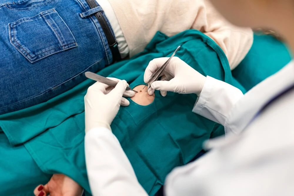 Minor Surgery-cover