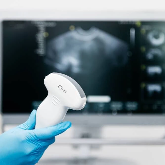 Ultrasound Scans