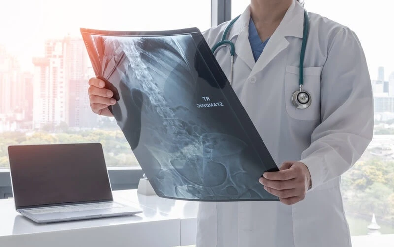 Abdominal X-Ray