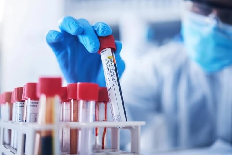 Blood Test