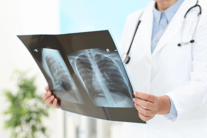 Chest X-ray