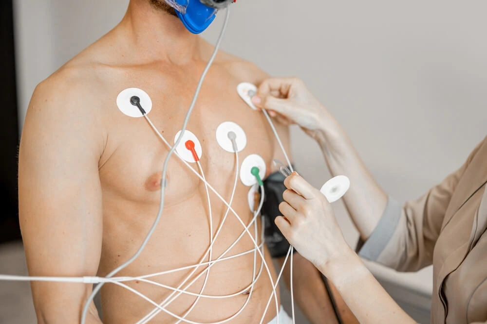 ECG Test
