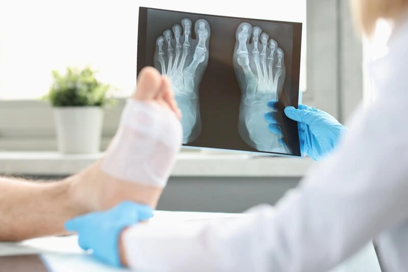 Extremities X-Ray