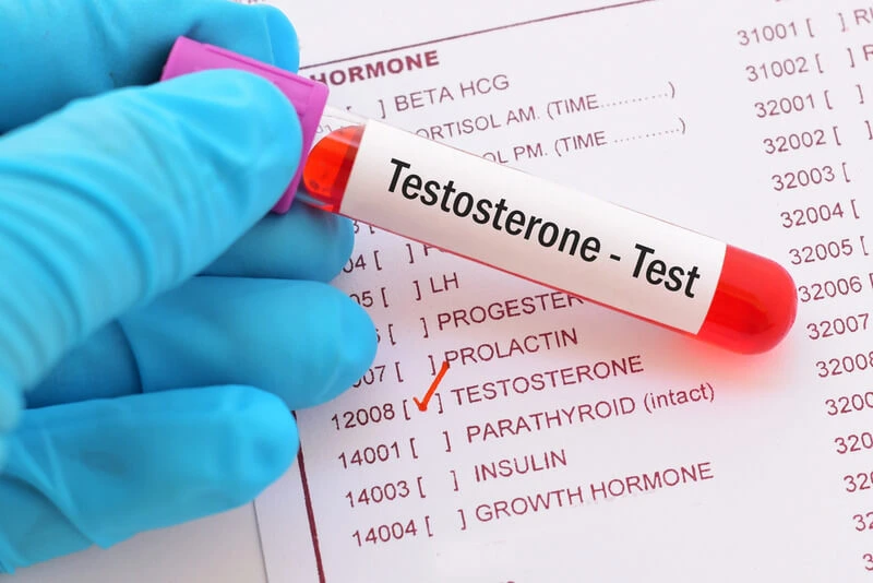 Testosterone Evaluation