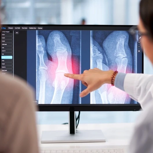 Bone X-ray